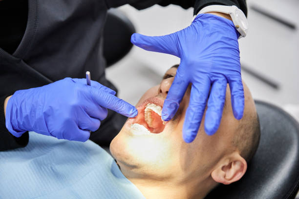 Best Emergency Dental Extractions in Mustang Ridge, TX
