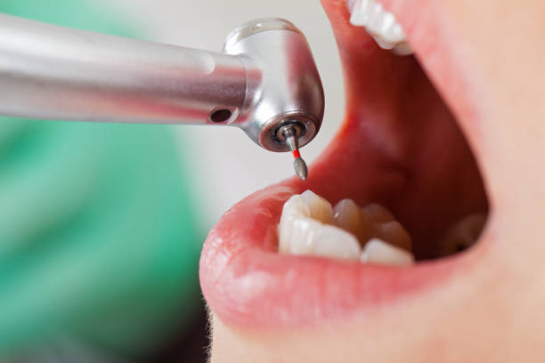 Best Emergency Root Canal Treatment in Mustang Ridge, TX